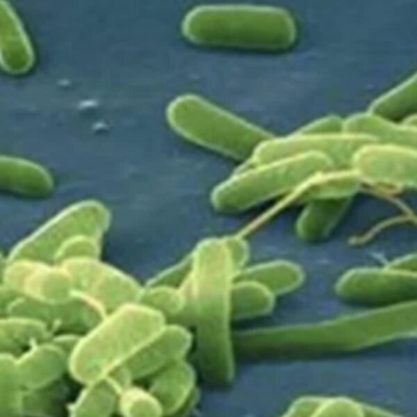 Mueren dos personas por bacteria comecarne en Louisiana&hellip;