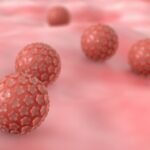 ¿Cómo saber que tengo VPH?