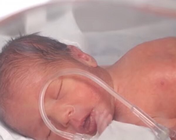 Cifras alarmantes de casos de sífilis en recién…